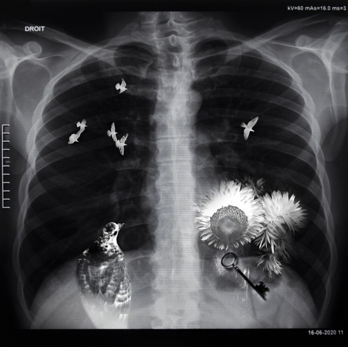Radiographie médicale d'un torse avec un oiseau, des fleurs et une clé qui apparaissent dedans